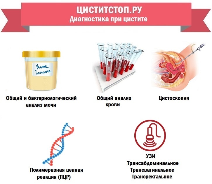ЦиститСтоп.ру — диагностика при цистите