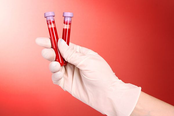 Кровь в лабораторных пробирках