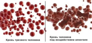 изменения в крови при употреблении алкоголя