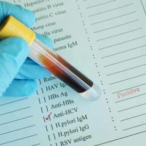 Диагностика при подозрении на наличие вируса гепатита В