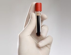 Как сдать анализ крови на кортизол