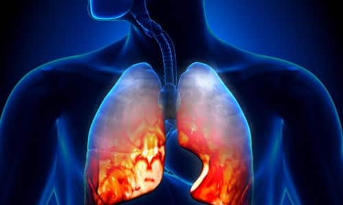Побочные эффекты со стороны органов дыхания проявляются развитием бронхоспазма, экспираторной одышки