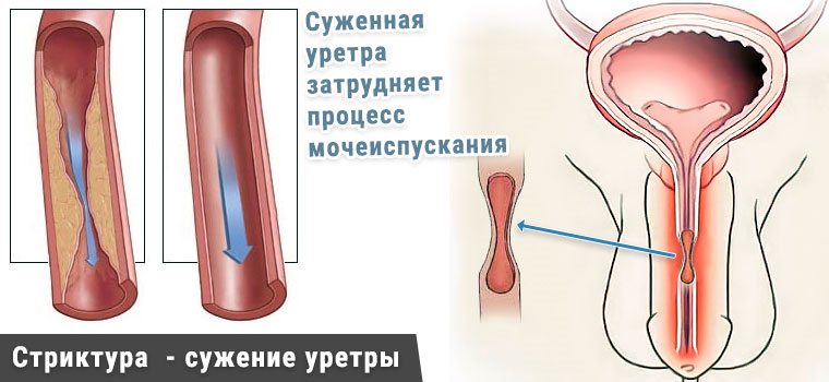 структура уретры
