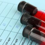 Алкоголь и биохимический анализ крови